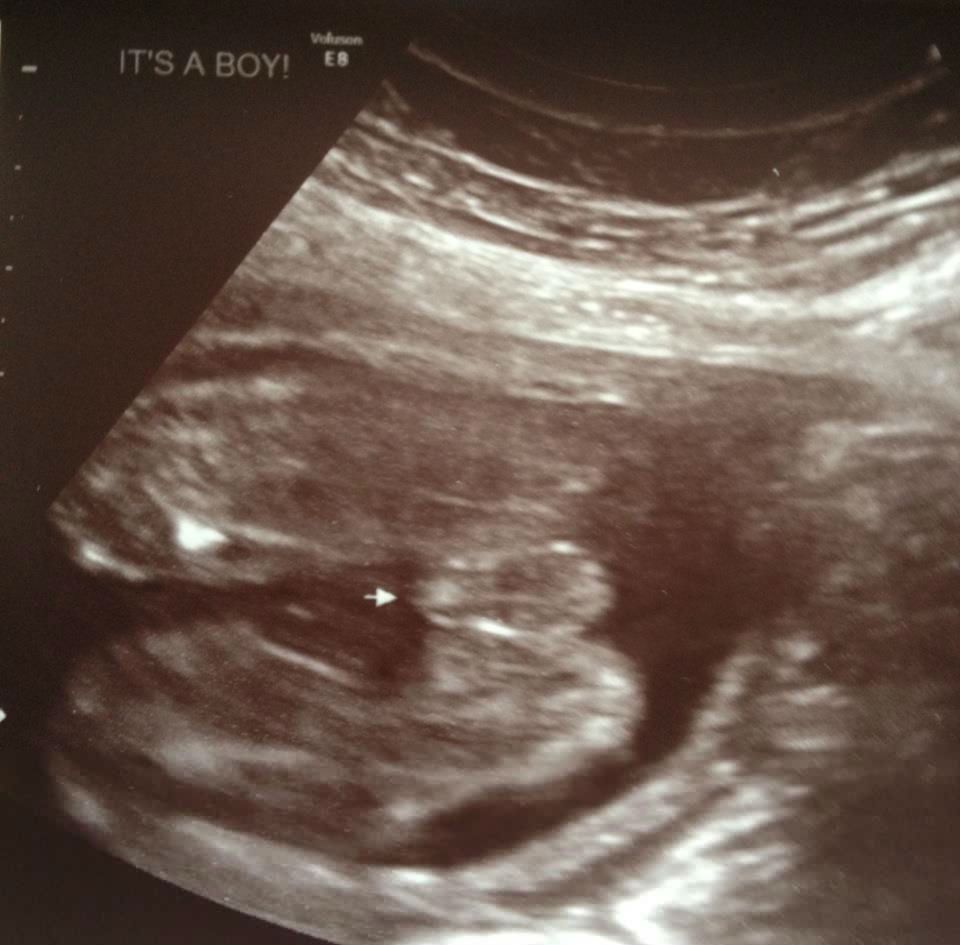 3D Potty shot BabyCenter