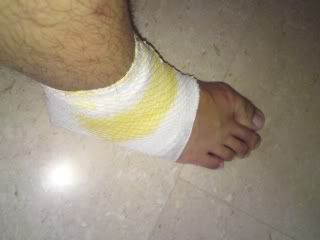 Foot bandage 2