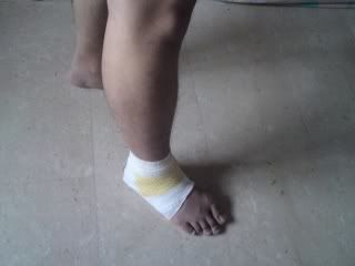 Foot bandage 1